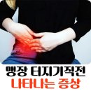 맹장 터지기직전 나타나는 증상 이미지