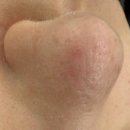 청담이상포항이동점 | 포항피부관리 포항윤곽관리 새미모에서 포항모공관리 받은 후기