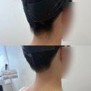 필헤어라인 - 북구 구암동 | 광주 예비신부 필수관리 헤어라인·뒷목 왁싱 통증 없이 받는 슈가앤필