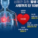 여자 왼쪽 가슴 통증 : 여자 오른쪽 가슴 통증 이미지