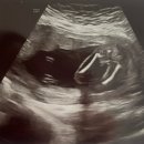 베스킨라빈스 앞 | 17주 성별확인 및 베스킨라빈스 젠더리빌 후기