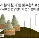증미경희한의원 네이버블로그