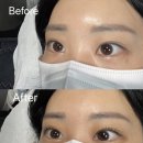 신기중학교 | 대구 율하동뷰러펌 &#34;감성뷰티&#34; 복구펌으로 손상없이 속눈썹펌 하고 온 후기