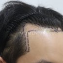 모먼트의원 이미지
