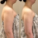 디자인올다 - 성북구 도봉로3길 21 | 다산다이어트 미올뷰티 티리온X 올다리프팅 예신 팔뚝 관리 후기