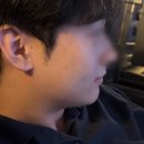 타임의원 | 직장인 리프팅 시술? 다운타임 없고 티 안 나는 ‘온다리프팅’ 후기 (feat. 강남타토아의원)