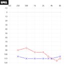 종로 보청기 이미지