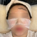 [범계피부관리]다다뷰티엔왁싱 피부결개선 스킨플래닝 후기