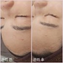 전주 피부관리는 유비홀릭