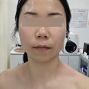 서영메디컬 | 옥길동피부관리 앰플폭탄 수분관리 기기관리 잘하는 부천에스테틱 미샵