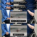 Surfer's Myelopathy 이미지