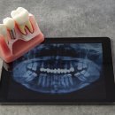 화이트365인천송도 티스토리