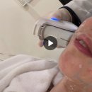 분당-400 | 압구정역피부과 울쎄라 400샷 솔직 통증 효과 후기