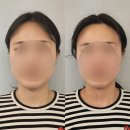 유니자세교합연구소 | 강남 바른얼굴윤곽연구소에서 부정교합 턱을 위한 자세교정 관리