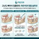 하은치과 네이버블로그