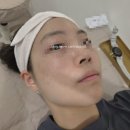 더드림한의원 | [내돈내산] 센텀 메디컬블룸 한의원 볼뉴머 400샷 1회차 솔직 후기! (ft. 할인 이벤트)