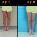 후메디앙스 이미지