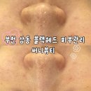장말로 | 부천 상동 신중동 피부관리ㅣ써니뷰티에서 받은 모공 블랙헤드 관리 솔직후기