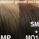 그로우모모 두피 탈모 케어센터 이미지