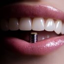 일산웰치과의원 이미지