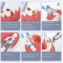 닥터크린[Dr. Clean] | 캐나다 워홀 치과위생사 ( DA )후기 ㅣ 로컬 치과 실습부터 취업까지