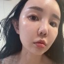 원진 | 닥터원진플러스 재생크림 솔직 후기｜히알루론산 수분크림 효능 체험