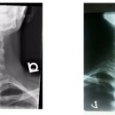경추 이미지