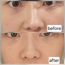 지성한방병원 | 속건조 보습에 좋은 하이드라페이셜매끄닝 후기 내돈내산