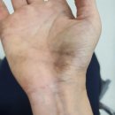 당고개동물병원 | [공지] 오프리쉬 대형견 개물림사고 노원구 당고개반려견임시놀이터