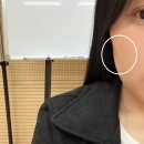 반포비앤씨피부과의원 | 라메종피부과에서 힐로웨이브로 옆볼꺼짐 해결한 솔직 후기(feat.전문의)