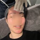 리쥬란 손주사보다 덜 아픈 하이쿡스로 멍 없이 물광피부 된 시술 후기