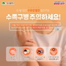 🏥 수포성 발진 일으키는 수족구병 주의하세요! 이미지