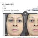 수블리 이미지