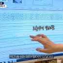 수면다원검사비용, 송파 40대 직장인 환자분