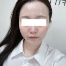영등포 피부관리 {슈티} 첫 스킨플래닝 후기