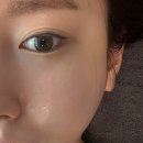 수연피부 | 하단피부관리 추천 수연에스테틱 웨딩관리 받고 온 솔직 후기