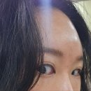 비앤비성형외과 이미지