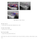 더힘의원 네이버블로그
