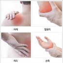 알파의료기 이미지