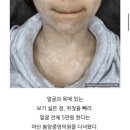 봉암중앙의원 네이버블로그