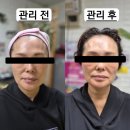 안산 피부관리실 후기좋은 깨끗한 피부나라 내돈내산