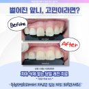 목천미소치과 네이버블로그
