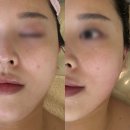 리스킨앤바디 (LEE skin&body) | 군포 부곡동 윤곽맛집 리스킨앤바디 피부관리
