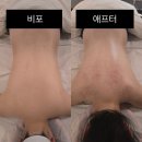 교연당 2층 | 검단피부관리 보떼드스파 테라노바 등 관리 후기 (수기+기계관리)