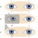 딥포커스안경원 이미지