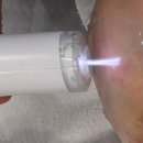 씨유청주강서서현점 | 청주피부샵 청주피부관리 여드름트러블 원장님실력좋은곳