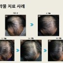더모헤어플란트피부과의원 이미지