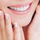 가까운치과기공소 이미지