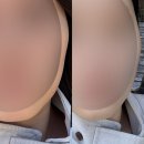 CU 광주화개점 | 광주 금호동 에스테틱 온윤 후기, 예신 신부관리 윤곽관리 1회 변화