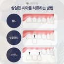 정도치과기공소 이미지